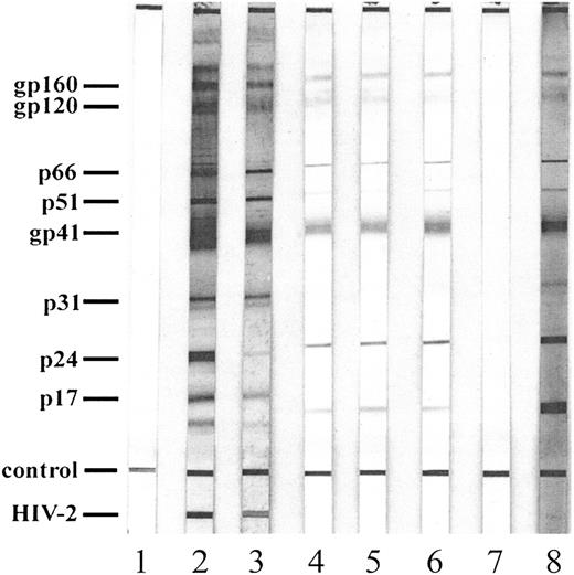 Figure 5. Reactivity of rabbit antimolecular mimicry Ab with HIV-1 proteins. Immunoblot of control sera (lane 1); 2 positive control sera (lanes 2 and 3); 3 rabbit antimolecular mimicry Ab sera, 1096, 1098, and 1099 (lanes 4, 5, and 6, respectively); preimmune rabbit sera (lane 7); and affinity-purified HIV-1-ITP patient sera (lane 8).