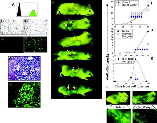 Figure 2. RTFI of SCID-hu mice with MMGFP+ lesions within human fetal bone. (A) Flow cytometric analysis indicates an approximate 2-log difference in mean fluorescence intensity of INA-6GFP+ cells (green peak) versus the parental INA-6 cells (black peak). (B-E) Microscopic analysis of INA-6GFP+ cells transduced with the GFP construct. Panels B and C refer to GFP- cells; panels D and E refer to GFP+ cells analyzed by either contrast-phase (B,D) or fluorescence microscopy (C,E) (original magnification × 100). (F) Representative imaging of 6 different SCID-hu mice following engraftment of INA-6GFP+ cells (2.5 × 106) into the human fetal bone (indicated by yellow arrows). (G-H) Serial sections of a human fetal bone engrafted with INA-6GFP+ cells. H&E staining (G) and fluorescence microscopy (H; original magnification ×200). (I-K) Dexamethasone, Atiprimod, and B-B4-DM1 treatments of SCID-hu mice engrafted with INA-6 cells; levels of shuIL-6R in SCID-hu mice sera were analyzed. The blue arrows indicate the day of treatment. (L) Images of a representative SCID-hu mouse bearing INA-6GFP+ lesions in human fetal bone before and after 2 consecutive days of treatment with B-B4-DM1 (150 μg DM1/kg intravenously). Fetal bone image enlargements are shown.