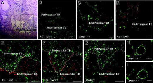 Figure 1. Platelets are localized around the endovascular trophoblasts within the maternal vessels. Sections of placental tissue from therapeutic hysterectomy at 9 weeks of gestation were double stained with rhodamine (red) and FITC (green). (E-G) Higher magnifications of the boxed area indicated in panel A. (A) H&E staining. (B) CD41 (platelet marker, red) and cytokeratin 7 (CK7, marker for trophoblasts and endometrial gland, green). (C) CD41 (red) and von Willebrand factor (VWF, endothelial marker, green). (D) CD45 (leukocyte marker, red) and VWF (green). (E) CD41 (red) and CK7 (green). (F) Collagen type IV (COL IV, red) and CK7 (green). (G) Fibronectin (FN, red) and CK7 (green). TB, trophoblasts. Platelets were confined within the maternal blood vessel (C). These platelets were attached to the vessel wall (dotted white lines), which was infiltrated by spindle-shaped perivascular trophoblasts (E) or adhered to the surface of round endovascular trophoblasts (E), where collagen type IV and fibronectin were deposited (F-G). Endometrial sections from nonpregnant women in the secretory phase (postovulatory day 7) were also double stained by CD45 and CD41 (red; H and I, respectively) and VWF (green). CD45+ immune cells were distributed around spiral arteries, but no platelets were observed within the spiral arteries. Scale bars indicate 100 μm. Original magnification × 120 (panels A-D), × 320 (panels E-G), and × 200 (panels H and I).