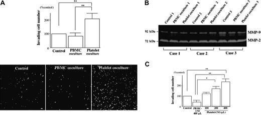 Figure 3. Platelet-derived soluble factors promote EVT migration. (A) Isolated human EVTs were allowed to invade through Matrigel toward human PBMCs or platelets that were cultured on collagen type I. After 12 hours, the EVTs that reached the lower surface were immunostained with cytokeratin 7 antibody (bottom) and counted for quantification using NIH Image 1.61 (top). Scale bars indicate 100 μm. Original magnification × 70. (B) At the end of the invasion assay, the culture medium was harvested from the upper well to evaluate the activity of MMP-2 and MMP-9 by gelatin zymography. (C) Matrigel invasion of isolated human EVTs toward PBMC-conditioned medium (CM) or platelet-CM was assessed by invasion assays.*P < .05; **P < .01.