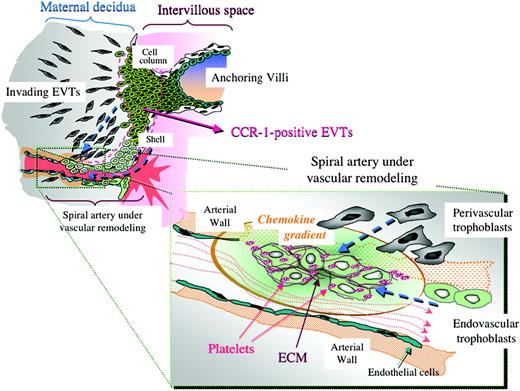 Figure 6. Possible chemokine gradient produced by platelets in spiral arteries and its estimated effects on trophoblast infiltration toward the arteries. In spiral arteries that are undergoing vascular remodeling, platelets and ECM are deposited among the endovascular trophoblasts. These platelets are likely to have been activated by trophoblasts or ECM and to have released various soluble factors including CCR1 ligands to form a local chemokine gradient around the remodeling spiral arteries. These processes may encourage further trophoblastic arterial infiltration and thus contribute to physiological vascular remodeling during human early pregnancy, providing a positive feedback cascade.