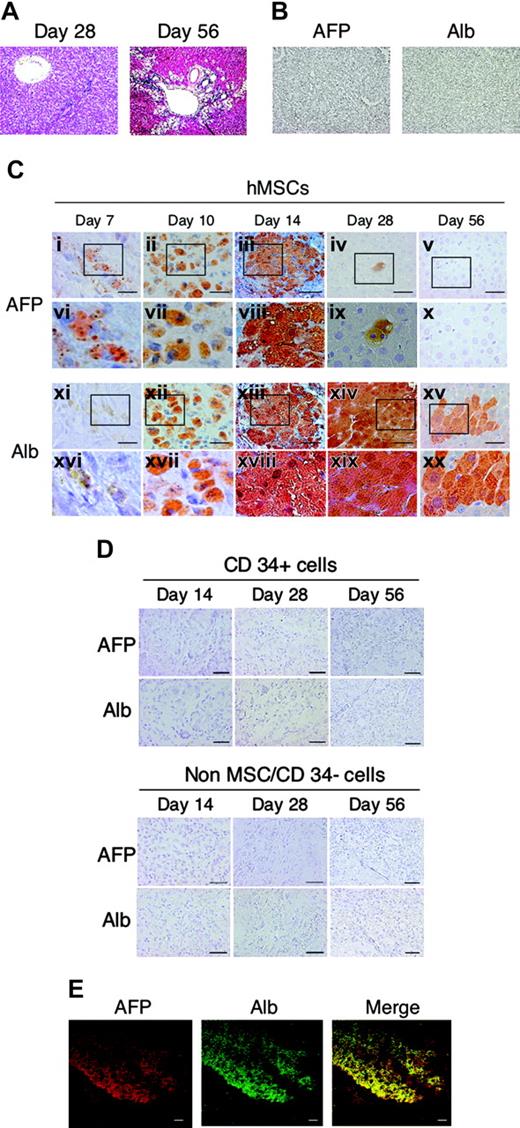 Figure 2. Immunohistochemical and immunofluorescent staining patterns for hAFP and hAlb in the multiple AA-treated rat liver that received a transplant of human bone marrow cells. (A) Representative hematoxylin-eosin (HE) staining of multiple AA-treated rat liver. Mild periportal necroinflammation and fibrosis characterized by mild portal expansion were observed at day 28. Severe septal fibrosis and swelling of hepatocytes is diffusely observed at day 56. (B) Sections of injured rat liver (day 28) from rats not given transplants were not stained at all with antibodies specific for hAFP and hAlb. Rats were treated with multiple AA and underwent transplantation with hMSCs (C) or CD34+ cells or non-hMSCs/CD34- cells (D) by means of direct injection into their liver. Serial cryosections were immunostained using monoclonal antibodies specific for hAFP (Ci-x) or hAlb (Cxi-xx). (vi-x) and (xvi-xx) are magnified images of corresponding squared areas of (i-v) and (xi-xv), respectively. Similar results were obtained in 2 independent experiments. (E) Immunofluorescent staining patterns for hAlb and hAFP in rat-injected hMSCs. Rats were treated with multiple AA. Fourteen days after intrahepatic injection of hMSCs, immunofluorescent images of liver sections were obtained using a confocal laser microscope (Bio-Rad, Radiance 2100) with the Alexa 568 (Molecular Probes)-labeled anti-human AFP antibody (clone C3, 1:500; Sigma) (red) and with the Alexa 488 (Molecular Probes)-labeled anti-human Alb antibody (clone HAS-11, 1: 500; Sigma) (green). Merged immunofluorescence images of hAlb and hAFP are also presented. Scale bars represent 20 μm. Original magnifications, × 100 (A-B, E); × 200 (Ci-v, xi-xv, and D; and × 400 (Cvi-x, xvi-xx).