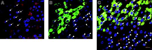 Figure 5. A representative image series from combined FISH for human and rat specific chromosomes and immunofluorescence for human albumin in the multiple AA-treated rat liver-transplanted hMSCs. (A) When viewed through a rhodamine and ultraviolet filter, positive human Y signals appear as red dots at the periphery of the nuclei stained with DAPI, a chromosomal marker that shows up as blue fluorescence. For ease of reference, the positive Y signals are highlighted by arrows. (B) The same field as in panel A is shown when overlaying the immunofluorescence images viewed through the FITC filter to demonstrate the immunostaining for the human albumin positive cytoplasm (green staining), and the rat-12 chromosome is represented by the green fluorescent dots (arrowheads). Nonhuman albumin-expressing cells which show background level of autofluorescence in injured rat liver tissue are seen surrounding the albumin-expressing cells. (C) Another representative image from different rat livers was made from overlaying the images seen through the 3 separate filters to show all the colors. Scale bars represent 20 μm. Original magnification, × 630.