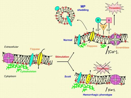 Membrane remodeling in normal and Scott cells. In the plasma membrane, dynamic maintenance or loss of asymmetric phospholipid distribution results from opposite fluxes under the control of specific transporters governing inward (flip) or outward (flop) translocation. In the resting membrane, the flippase activity of aminophospholipid translocase is prominent and subtained (left, yellow ellipse). Thus, aminophospholipids, phosphatidylserine (PS; red negative polar heads), and phosphatidylethanolamine (PE; open polar heads) are sequestered into the inner leaflet. Following stimulation, specific vectorial floppase and/or nonspecific bidirectional scramblase activities are rapidly turned on, and PS and PE are moved to the outer leaflet (upper right). Flippase activity is shut down, leading to transient mass imbalance between the two leaflets. Membrane blebbing ultimately resolves into microvesicle or microparticle (MP) shedding after cytoskeleton degradation by calcium-dependent proteolysis. Stimulated cell membrane and MP therefore expose PS, which is particularly crucial in platelet procoagulant response for the calcium-dependent assembly of the cascade of clotting enzyme complexes. The assembly of these complexes, composed of an enzyme (E) and a cofactor (C) in the activation of a substrate (S), culminates in the generation of sufficient thrombin for efficient hemostasis. In resting Scott cells, flippase activity is indeed operational; stimulation remains without effect on the swift induction of floppase and/or scramblase and consecutive membrane shedding, explaining the resulting hemorrhagic phenotype (lower right). During the slower process of apoptotic cell death, however, PS egress is normal in Scott cells. As yet, floppase candidates have remained elusive.