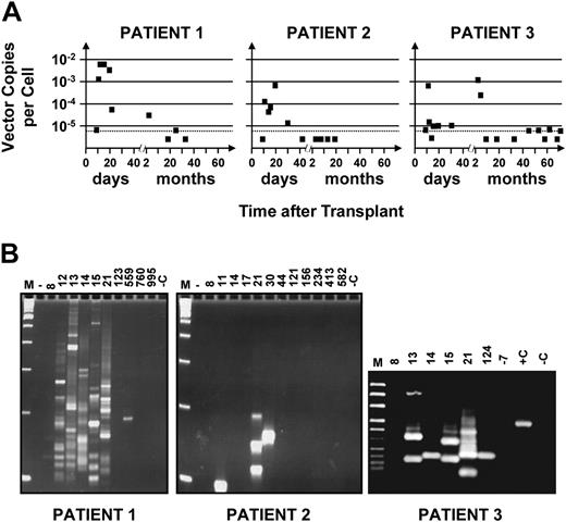 Figure 1. Kinetics of appearance and disappearance of marked cells in recipients of retrovirally transduced mobilized PB cell autografts. (A) Time course studies revealing an early contribution of marked cells to the WBCs produced in the first 3 weeks in all 3 patients studied with variable patterns of contribution at later times. DNA was extracted from sequentially obtained samples of PB cells from each patient, and proviral sequences were detected using primers designed to amplify a 589-bp 5′ vector sequence. Quantification of the proportion of WBCs that were marked was achieved by comparing the intensity of the signal obtained from each sample to control DNA from HeLa cells that contained a single copy of the provirus that was then serially diluted in DNA extracted from nontransduced HeLa cells. Analysis of 1 μg template DNA (∼ 1.5 × 105 test cells) at each time point allowed the limit of gene-marked cells detectable to be reduced to close to 0.001% (assuming 1 vector copy per cell, dashed horizontal line). (B) Detection of different proviral integration sites in PB cells using LAM-PCR. The data indicate that multiple clones contributed to the early output of retrovirally marked WBCs in all 3 patients. M indicates a 100-bp DNA ladder; +C, positive control (0.02 ng DNA from monoclonal HeLa cells transduced with the same vector); and –C (1 μg nontransduced HeLa DNA), as well as –7 (DNA extracted from the PB of this patient taken 7 days before the transplantation was performed), negative controls.