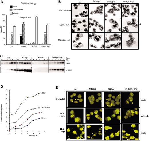 Figure 5. Analysis of differentiation-associated characteristics of M1, M1myc, M1Egr-1, and M1Egr-1/myc cells. Cells were seeded at 0.05 × 106 cells/mL with or without IL-6 (50 ng/mL). (A) After 3 days cells were harvested and cell morphology was determined, as described in Figure 3, and “Materials and methods.” Results are the average of 3 independent experiments yielding similar results with an SD up to 10%. Using mature cells as a measure of cell differentiation, the differences between M1myc and each of the other 3 cell lines used were P < .01 (significant), between M1 and M1Egr-1/myc P > 0.1 (not significant), and between either M1 or M1Egr-1/myc and M1Egr-1 P < .05 (significant). (B) Photomicrographs of M1, M1myc, M1Egr1, and M1Egr1-myc cells from May-Grünwald-Giemsa–stained cytospin smears untreated and after 3 days of treatment with either 1 ng/mL or 50 ng/ml IL-6. Slides were analyzed and photographed (original magnification, × 400). Images were cpatured with a Zeiss Axioplan microscope using a 40×/0.75 NA Neofluar lens and a SenSys camera (Roper Scientific, Tucson, AZ) and SmartCapture 2 software (Digital Scientific, Cambridge, United Kingdom). (C) Expression of ferritin and lysozyme mRNA was determined by Northern blot analysis using of total RNA as described in “Materials and methods.” This is a representative experiment that was carried out 3 times. (D) F4-80 expression was determined using FITC-conjugated anti–F4-80 primary antibody and flow cytometry, as described in Figure 3 and “Materials and methods.” (E) Photomicrographs of phagocytosis analysis showing cells phagocytosing latex beads. Cells were seeded in the absence or presence of IL-6 and incubated with or without latex beads as described in “Materials and methods.” Images were captured using a Nikon dissectin microscope (SMZ-U, zoom 1:10) and an ED Plan APO lense (Nikon, Surrey, United Kingdom) and a Nikon CoolPix 990 camera and were processed with Adobe Photoshop (Adobe Systems, San Jose, CA). Photomicrographs are representative of at least 30 fields examined per cell line. Results are shown for M1Egr-1/myc6. Similar data were obtained with M1Egr-1/myc7.