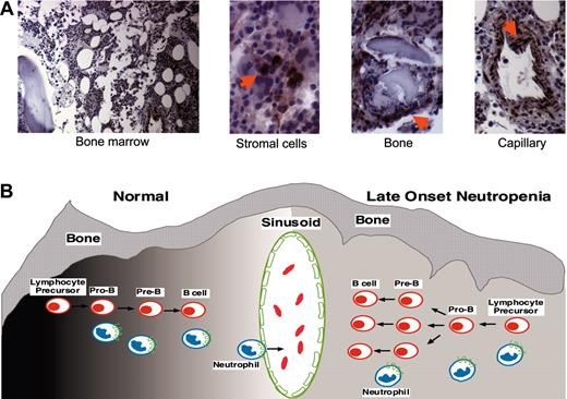 Figure 5. Bone marrow SDF-1 immunohistochemistry and model of late-onset neutropenia. (A) SDF-1 detection in the bone marrow of a patient with LON. SDF-1 is expressed by bone marrow stromal cells, which are dispersed throughout the bone marrow; osteoblasts that are juxtaposed to the bone trabeculae; and endothelial cells that line the blood capillaries. Sections immunostained for SDF-1 with specific antibodies. Images were collected using a Nikon Eclipse 6600 microscope (10×/0.45 DICL and 40×/0.95 DICM lenses; Nikon, Tokyo, Japan) with a Retiga 1300 digital camera (QImaging, Burnaby, BC, Canada) and IP Lab acquisition software (Scanalytics, Fairfax, VA). Images were imported into Adobe Photoshop software (Adobe Systems, San Jose, CA). (B) A model of late-onset neutropenia is shown. Early B-cell lymphopoiesis and neutrophil egress into the bone marrow sinusoid is regulated by SDF-1 gradients (dark to light shading, left) within the bone marrow microenvironment, as shown on the left. In a patient with LON, we hypothesize that the SDF-1 gradients are transiently disrupted (even gray shading, right) within the bone marrow microenvironment due to SDF-1 consumption by rapidly expanding B cells, resulting in the temporary inhibition of neutrophil egress across the sinusoid, as shown on the right. SDF-1–positive cells are indicated by arrows.