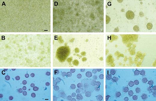 Figure 2. OPN-stimulated DCs show morphologic signs of activation. DCs derived from peripheral blood monocytes were left untreated (A-C), or stimulated with 0.5 μg/mL OPN (D-F) or 10 μg/mL LPS (G-I) on day 5 of culture. Photographs of cultures were taken 24 hours (A,D,G) and 48 hours (B,E,H) after addition of the stimulus. Bar in panel A for magnification in panels A-B, D-E, G-H: 150 μM. For morphologic evaluation of DCs, cells were cultured as described in “Materials and methods,” and after 48 hours of treatment, unstimulated DCs (C), OPN-stimulated DCs (F), or LPS-stimulated DCs (I) were fixed on adhesion slides and stained immunohistochemically with antibodies against HLA-DR. Bar in panel C for magnification in panels C,F,I: 15 μM. Panels A-B, D-E, G-H: Cell cultures were analyzed with an Axiovert microscope (Zeiss, Göttingen, Germany) using a Zeiss 10.0 objective lens providing a 10-fold magnification. Panels C, F, I: Adhesion slides were analyzed with an Axioskop microscope (Zeiss) with oil immersion using a 100× objective lens (Plan Neofluar objective, Zeiss). Photos were taken with a Canon EOS 300V (Canon, Krefeld, Germany) used as an onboard camera without additional optical lenses. All slides were scanned with CanoScan (Canon), and images were assembled with CorelDraw 11.