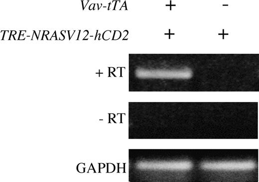 Figure 2. Expression of NRASV12 in bone marrow of line 6468 mice by RT-PCR. Total bone marrow was harvested from singly and doubly transgenic littermates, as indicated, and total RNA was extracted. RNA was DNase treated, and NRAS RT-PCR was performed with (+RT) and without (-RT) reverse transcriptase. Glyceraldehyde-3-phosphate-dehydrogenase (GAPDH) RT-PCR was performed on the same samples to verify integrity and loading.