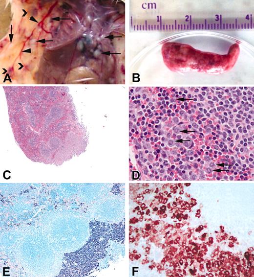 Figure 4. Gross appearance and histology of spleen from affected mice. A portion of the spleen from affected animals was fixed in 10% phosphate-buffered formalin, and histologic examination was performed. (A) Gross appearance of a typical animal including focal tumors in the skin and pleura/peritoneum (arrows), dilated blood vessels (arrowheads), and subcutaneous hematomas (chevrons). (B) Typical spleen from an affected animal. (C) Hematoxylin and eosin stain of spleen from line 6468. (D) Higher magnification of panel C showing infiltration of granulocytes (arrows) in the spleen. (E) Giemsa stain of spleen in panel C showing diffuse and focal infiltrates of cells containing basophilic granules consistent with mast cells. (F) Mast cell tryptase immunohistochemistry of the spleen from an affected animal. Original magnifications: (C) × 4, (D) × 40, (E) × 10, (F) × 40.