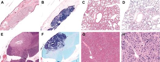 Figure 5. Histologic examination of other tissues in affected animals. Hematoxylin (A,C,E,G) and Giemsa (B,D,F,H) stains of various tissues from affected animals. (A-B) Subcutaneous tumor in the skin. (C-D) Widespread infiltration of the lung. (E-F) Mast cell tumor in thymus. (G-H) Small, widespread infiltrates in the liver. Infiltrates were also seen in the kidney and lymph nodes of some animals (data not shown). Original magnification, × 10 in all panels.