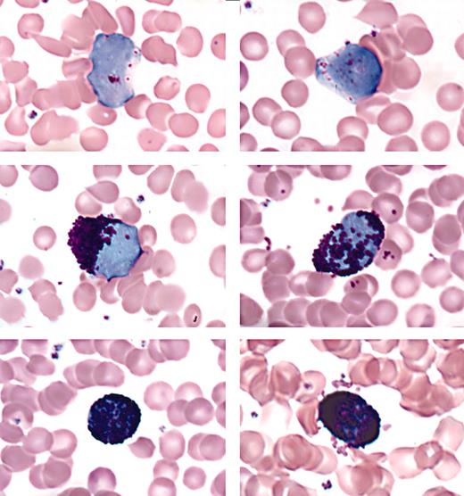 Figure 6. Mast cells in the peripheral blood of doubly transgenic animals. Peripheral blood from affected animals was examined for the presence of mast cells (modified Wright-Giemsa stain). Granulocytes in varying stages of development are shown, including immature myeloid forms, each with a few metachromatic granules (top row), immature or atypical mast cells (middle row), and mature mast cells (bottom row). Original magnification, × 63 in all panels.