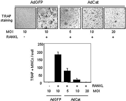 Figure 4. Suppressive effect of an antioxidant enzyme, catalase, on RANKL-induced osteoclastogenesis in BMM cells. (Top) BMM cells were infected with a recombinant adenovirus for catalase (AdCat) or the control adenovirus expressing GFP (AdGFP) with the indicated MOI (multiplicity of infection). On day 5, infected cells were stained for TRAP, and TRAP-positive MNCs were counted (bottom). Formation of TRAP-positive MNCs was severely suppressed in catalase virus-infected BMM cells (original magnification, × 100). Data represent means ± SDs of 3 independent experiments, each performed in triplicates.