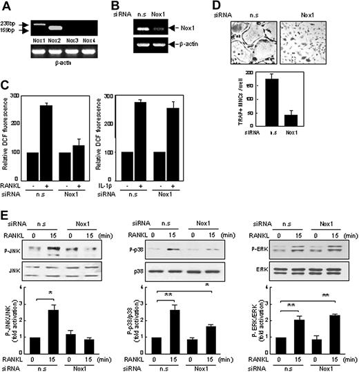 Figure 6. Inhibition of RANKL responses by Nox1 siRNAs in BMM cells. (A) RT-PCR analysis of the expression of Nox isoforms in BMM cells. Expected product sizes of Nox 1 to 4 are 238 base pair (bp), 159 bp, 209 bp, and 220 bp, respectively. Expression of Nox1 and Nox2 mRNAs was indicated with arrows. n.s or Nox1-specific siRNAs were synthesized and transfected into BMM cells (B-E). (B) Specific reduction of Nox1 mRNA was shown by RT-PCR. (C) BMM cells transfected with nonspecific (n.s) or Nox1 siRNAs were treated with RANKL or interleukin 1β (IL-1β) for 10 minutes, and ROS levels were determined as in Figure 1A. (D) On day 5, cells were fixed and stained for TRAP. Formation of TRAP-positive MNCs was severely suppressed by Nox1 siRNAs (original magnification, × 100). (E) As in panel C, except that whole-cell extracts were detected with phosphopeptide-specific Abs as in Figure 3A. *P < .05; **P < .005. Data represent means ± SDs of 3 independent experiments, each performed in duplicate (C-E).