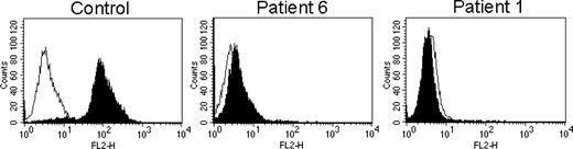 Figure 2. Cytofluorimetric analysis of perforin using δG9 mAb. FACS profiles of staining of control and patient CTLs with δG9 antiperforin. Nonspecific staining with an isotype-matched control antibody is shown by the open histograms. FL2-H indicates fluorescence channel 2.