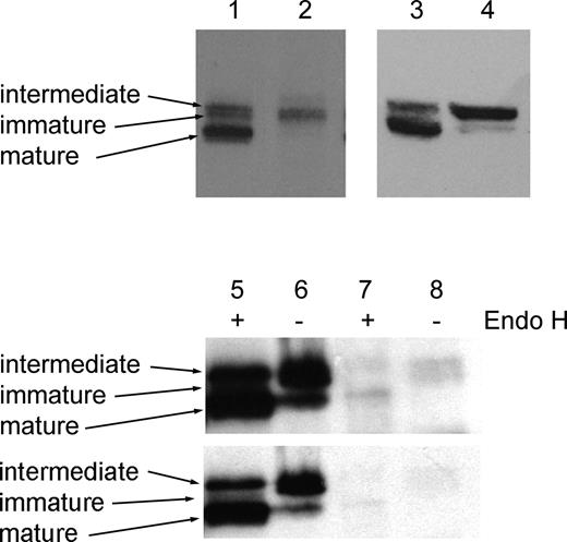 Figure 4. Processing of perforin to the mature form is impaired in patient CTLs. Western blots of CD8+ CTL lysates from control (lanes 1,3) and patient (lanes 2,4), showing immature, intermediate, and mature forms of perforin in control CTLs, and only the immature and intermediate forms in patient 612. Longer (top) and shorter (bottom) exposures of lysates from NK cells from control (lanes 5-6) or patient 6 (lanes 7-8) were incubated in the presence (lanes 5,7) or absence (lanes 6,8) of Endo H and probed with 2d4-antiperforin. All samples were run on 7.5% acrylamide gels under nonreducing conditions.