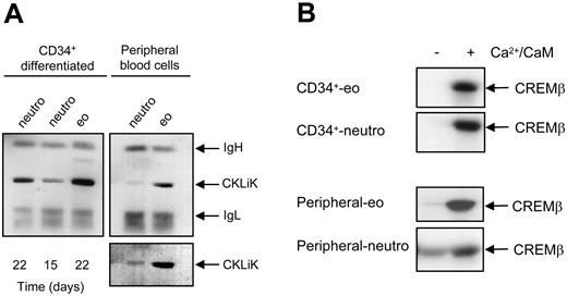 Figure 3. Expression and activation of CKLiK in human eosinophils and neutrophils. (A) CKLiK was immune-precipitated with CKLiK antibody from stem cells differentiated toward neutrophils (neutro; 2.5 × 107 and 1.5 × 107 as indicated) and eosinophils (eo; 1.5 × 107) (left) and from peripheral blood neutrophils (2 × 107) and eosinophils (107) (right, with a longer exposure below) and separated by SDS-PAGE. Western blot analysis was performed with the CKLiK antibody. Heavy and light chains of CKLiK antibody and immune-precipitated CKLiK are indicated. (B) Kinase activity of CKLiK is dependent on Ca2+/calmodulin (Ca2+/CaM). Kinase assays were performed in the absence or presence of Ca2+ and calmodulin with CKLiK immune-precipitated from stem cells differentiated toward neutrophils and eosinophils (top) and with CKLiK obtained from peripheral blood eosinophils and neutrophils (bottom). Data are representative of 3 independent experiments.