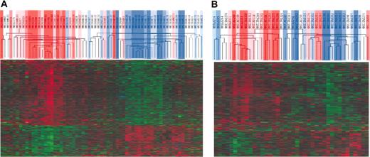 Figure 3. Unsupervised hierarchical clustering of TACIhi and TACIlo MMCs. The 659 genes that statistically (P = .01) distinguished (ratio 1.5 or 0.67) TACIhi patients and TACIlo patients are presented graphically using hierarchical clustering. The color of each cell in the tabular image represents the expression level of each gene (red, expression higher than the mean; green, expression lower than the mean; increasing color intensity represents a higher magnitude of deviation from the mean). The TACI40lo, TACI25lo, and TACI15lo subgroups were represented by graded blue color (more intense in TACI15lo) and the TACI40hi, TACI25hi, and TACI15hi) subgroups were represented with graded red color (more intense in TACI15hi). (A) Initial set of 65 patients. (B) Validation set of 40 patients.