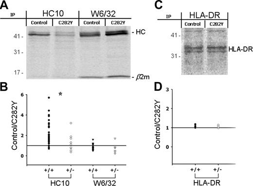 Figure 4. The β2-m–assembled and free MHC class I HC levels are altered in C282Y mutant cells in an allele-dependent manner. (A) PBMCs with (C282Y) or without (control) the C282Y mutation were 35S-labeled for 2.5 hours and class I molecules recovered with HC-10 and W6/32 mAbs and subjected to 10% SDS-PAGE. The position of the MHC class I HC and β2-m are indicated. Molecular weight markers are shown on the left. Data shown represent one individual experiment using PBMCs from one WT blood donor and one C282Y homozygous patient with HH of a total of 40 studied. (B) MHC class I HC bands were quantified by phosphoimaging. In each individual experiment one control blood donor and one patient with HH carrying the C282Y mutation were tested. The intensity of the control bands was divided by the C282Y bands. The ratios were plotted according to the patient's HFE genotype: C282Y homozygous (+/+; •/▾); C282Y heterozygous (+/-; ○/▿). *P < .05. The means ± SD of 40 experiments with the following distribution are shown: HC-10 (C282Y+/+), 31; HC-10 (C282Y+/-), 9; W6/32 (C282Y+/+), 23; W6/32 (C282Y+/-), 6. (C) As a control experiment, HLA-DR was recovered from control and C282Y 35S-labeled PBMCs and resolved on a 10% SDS-PAGE. (D) The control/C282Y ratios of the band intensity were plotted according to patient's HFE genotype. Data are representative of 6 individual experiments.