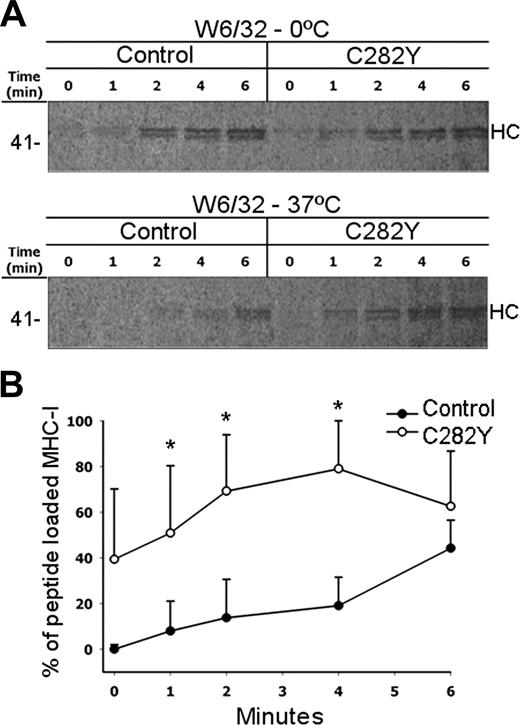 Figure 5. Peptide loading is faster in C282Y homozygous cells. (A) PBMCs without the C282Y mutation (control) or C282Y homozygous (C282Y) were 35S-labeled during 5 minutes and chased for the indicated times. Half the lysates were incubated at 37°C and the other half maintained at 0°C. MHC class I complexes were recovered with W6/32 mAb and subjected to 10% SDS-PAGE. Molecular weight markers are shown on the left. Data shown represent one individual experiment using PBMCs from one WT blood donor and one C282Y homozygous patient with HH. Five experiments with similar results were done. (B) Percentage of peptide-loaded MHC class I molecules present at each chase time. Note the significant difference in the appearance kinetics of class I molecules when maintained at 0°C and after 37°C exposures. *Statistically significant difference between the C282Y mutants and the controls (P < .05). Data are representative of 5 independent experiments (each performed with PBMCs from one WT control blood donor and one C282Y homozygous patient with HH).