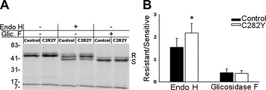 Figure 6. ER egress of class I molecules is faster in C282Y mutants. (A) After 2.5 hours 35S-metabolic labeling, W6/32 immunoprecipitates were digested for 6 hours at 37°C with Endo H, n-Glycosidase F, or mock treated and separated by 10% SDS-PAGE. The position of the resistant and sensitive forms of MHC class I HCs is indicated (R and S, respectively). Molecular weight markers are shown on the left. (B) Digestion-resistant and -sensitive class I forms were quantified by phosphoimaging and are presented as an R/S ratio. *Statistically significant difference between the C282Y mutants and the control cells (P < .05). Data are representative of 5 independent experiments, each performed with cells from one WT control blood donor and one C282Y homozygous patient with HH.