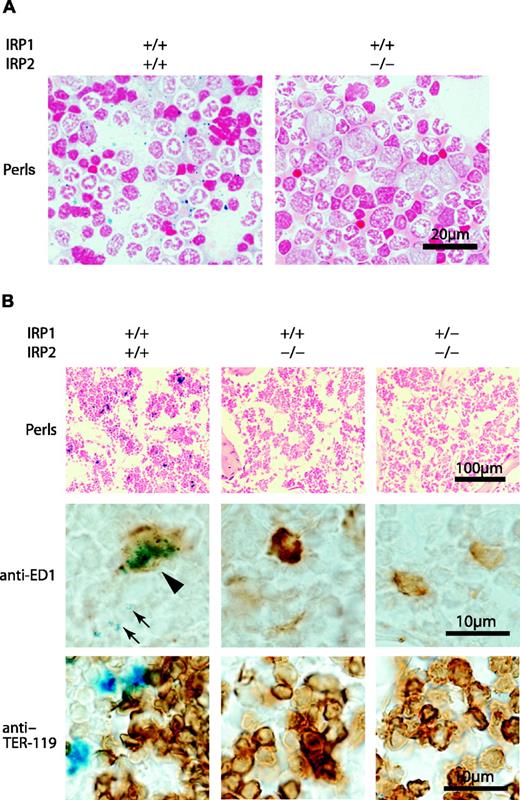Figure 1. Bone marrow iron is absent in bone marrow aspirates and sections of IRP2-/- and IRP1+/- IRP2-/- mice. Perls stain (Prussian blue with safranin counter-stain) of WT (IRP1+/+ IRP2+/+) shows abundant iron stores, whereas iron is virtually undetectable in bone marrow aspirates of IRP1+/+ IRP2-/- and IRP1+/- IRP2-/- animals (A). In lightly fixed bone marrow biopsies, iron is visible in WT but not in IRP2-/- and IRP1+/- IRP2-/- animals (top panel, B). On higher magnification, iron is detectable in WT macrophages (arrowhead points to blue iron deposits within brown cell identified as a macrophage by antibody to ED1 in middle row, B) and as siderotic granules in erythroid precursors (arrows). In bottom panel, antibody to TER-119 indicates erythroid lineage cells, but siderotic granules cannot be seen because the brown anti-TER-119 stain obscures them. Bone sections were obtained from age-matched 12-month-old females. Imaging was performed using a Nikon Eclipse E600 microscope (Nikon Instruments, Melville, NY) equipped with a 10×/0.45 objective lens (B, top panels) or a 60×/1.4 oil-immersion objective lens along with Nikon Type A immersion oil (A; B, middle and bottom panels). Images were captured with a Nikon DXM 1200F digital camera and Nikon ACT-1 2.62 imaging software. Images were processed with Adobe Photoshop 7.0 (Adobe Systems, San Jose, CA) and Adobe Illustrator 10.0 software programs.