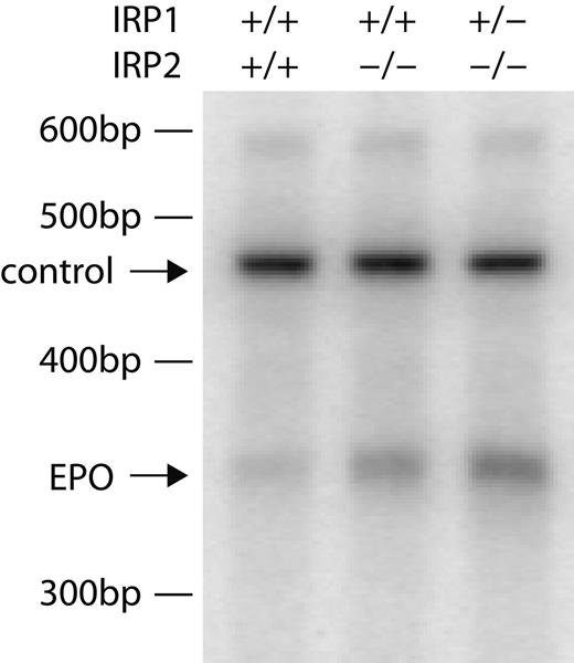 Figure 4. Kidney erythropoietin transcript levels are increased in IRP2-/- and IRP1+/- IRP2-/- mice. RNA extracted from kidneys of WT, IRP2-/-, and IRP1+/- IRP2-/- mice was assessed by relative quantitative PCR as described in “Materials and methods.” As a control, the 18S ribosomal subunit was amplified (top arrow) and erythropoietin mRNA (Epo) was amplified simultaneously (bottom arrow), indicating that erythropoietin mRNA levels increase significantly in kidneys of IRP2-/- animals and more prominently in IRP1+/- IRP2-/- mice. bp indicates base pair.