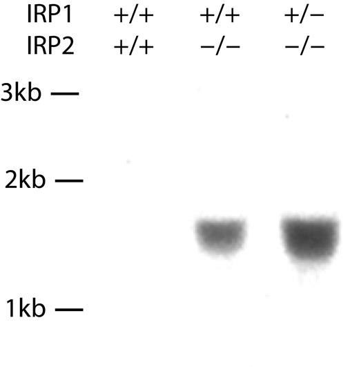 Figure 5. Hydroxymethylbilane synthase mRNA levels are increased in RNA preparations from IRP2-/- IRP1+/- IRP2-/- spleens. Spleen RNA was prepared and Northern blots were probed for levels of hydroxymethylbilane synthase, as described in “Materials and methods.” To evaluate total iron (heme and nonheme) content of tissues in IRP2-/- mice, we performed ashing and analyzed total iron levels in spleen, brain, and liver (Table 4). Total spleen iron was unchanged in IRP2-/- and IRP1+/- IRP2-/- mice relative to WT controls. Total brain iron was also unchanged, while total liver iron was increased in IRP1+/- IRP2-/- mice relative to wild type. Kb indicates kilobase.