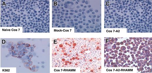 Figure 7. Immunocytologic staining for RHAMM/CD168 in naive versus transfected COS7 cells. The cell line K562 served as a positive control (D). ICS for RHAMM/CD168 in RHAMM/CD168 single-transfected COS7 cells (E) and RHAMM/CD168&HLA-A2 permanently double-transfected COS7 cells (F) showed a strong expression of RHAMM/CD168 in all transfected cells, whereas RHAMM/CD168 protein was not expressed in naive COS7 cells (A), COS7 cells mock transfected with the vector pBudCE4.1 (B), or COS7 cells solely transfected with HLA-A*0201 but not with RHAMM/CD168 (C). All photomicrographs were taken at a magnification × 100.
