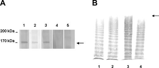 Figure 2. Immunoblot of anti–ADAMTS13 IgG and VWF multimeric pattern. (A) Immunoblot showing the presence of IgG reacting with recombinant (r) ADAMTS13. Serum samples were reacted with human rADAMTS13 previously transblotted to a nitrocellulose membrane. The presence of IgG was detected by a peroxidase conjugate goat anti–human IgG antibody. Lane 1: patient serum collected during an acute phase; lane 2: patient serum collected at remission before plasma (day –23); lane 3: patient serum collected at day 0 before rituximab treatment; lane 4: patient serum at day 123; and lane 5: serum from a healthy subject. The time of sampling is indicated by the upward-pointing filled arrowhead in Figure 1B. In samples containing an inhibitor, a reactive band of about 170 kDa corresponding to rADAMTS13 was found (arrow). (B) Representative images of VWF multimers in patient and control plasma. The origin of the gel is on the top; the arrow indicates the position of UL VWF multimers. Lane 1: control plasma pool; lane 2: patient sample collected before plasma at day –23; lane 3: patient sample collected before rituximab infusion (day 0); and lane 4: patient sample collected at day 88. The time of sampling is indicated by the vertical double-headed arrow in Figure 1B.