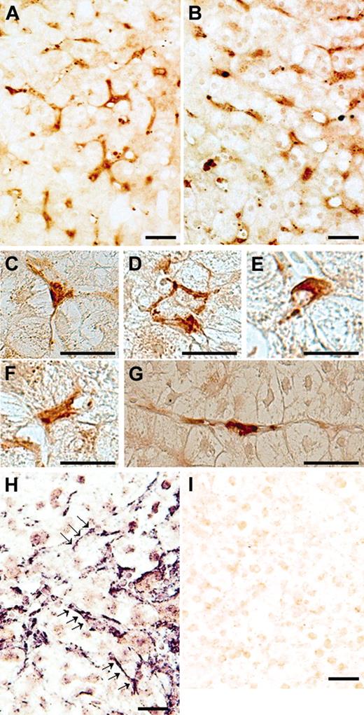 Figure 1. ADAMTS13 protein and mRNA expression in frozen sections of a liver specimen from a patient with hepatitis C–related chronic hepatitis. Immunostaining using ADAMTS13-specific monoclonal antibodies (A10) showed dense brown staining in perisinusoidal cells, but not in hepatocytes, inside the lobule (A). When the same liver section was stained with C7 antibodies, staining patterns were similar to those of A10 antibodies (B). The positive cells had a variety of morphologic forms. Examples shown here include a tripolar cell with long processes extending between hepatocytes (C), combined cells surrounding a hepatocyte (D), a dome-shaped cell (E), a bipolar cell with short processes (F), and a unipolar cell with long processes (G). Panels A-B: original magnification, × 200; panels C-G: original magnification, × 400. ADAMTS13 mRNA expression was examined using in situ hybridization. Strongly positive labeling was seen only in perisinusoidal cells, which were unipolar to dendritic in shape with irregularly elongated cytoplasmic processes extending between hepatocytes (H, arrows; original magnification, × 200). When sense probes were used, we observed no significant staining (I; original magnification, × 200). (Bar = 30 μM in A-I.)