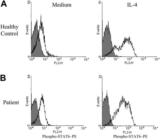 Figure 4. Tyrosine phosphorylation of STAT6 in response to IL-4. PBMCs obtained from a healthy control subject (A) and from a patient with lymphoma 3 months after transplantation (B) were incubated for 1 hour in medium alone or medium containing 10 ng/mL IL-4 as indicated and analyzed for intracellular expression of phospho-STAT6 by flow cytometry as described in “Patients, materials, and methods.” Logarithm of red fluorescence is displayed on the abscissa and relative cell number on the ordinate. Staining with PE-conjugated anti–phospho-STAT6 mAb is indicated by open histograms and staining with PE-conjugated control mAb by shaded histograms. Expression of phospho-STAT6 after IL-4 stimulation did not differ significantly (P > .4) when comparing control PBMCs (n = 3) with posttransplantation patient PBMCs (n = 6).