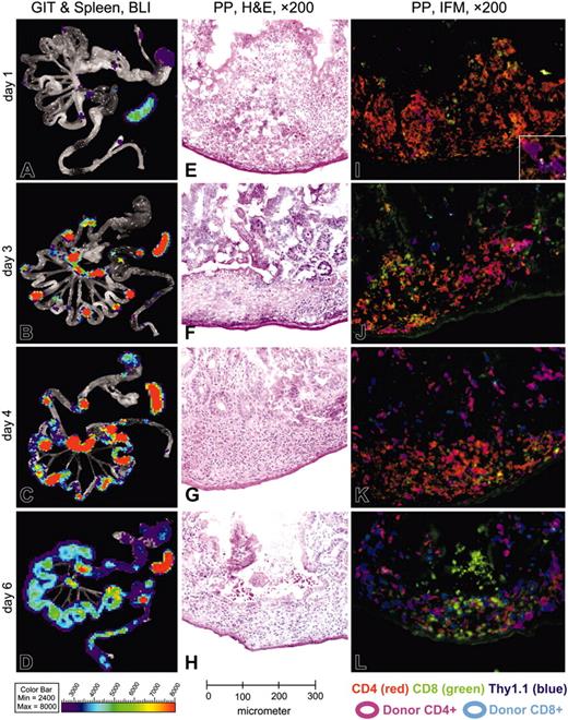 Figure 2. BLI of gastrointestinal tissues and spleen combined with histology and immunofluorescence microscopy of Peyer patches during induction of acute GVHD. (A-D) Until day 3 after allogeneic HCT, BLI signals increase over Peyer patches (PPs), mesenteric lymph nodes (mLNs) and the spleen, while staying confined to these organs. Day 4 represents a transition, showing spread of BLI signals within the small bowel, preferentially in areas adjacent to PPs. Day 6 shows a diffuse BLI signal, covering the entire GIT. BLI signal increased over the spleen until day 3 and remained highly positive until day 6. (E-H) In H&E staining, the PPs of day 1 show irradiation-induced necrosis of B-cell follicles surrounded by large macrophages loaded with nuclear debris, which showed a high degree of green autofluorescence (compare panels I-L). Between days 3 and 4 the B-cell follicles disappear completely and are replaced by histiocytic infiltrates, while the T-cell zones appear to be conserved. On day 6 the architecture of PPs is further disturbed by a collapse of dome regions, leaving behind a flat structure, diffusely infiltrated by lymphocytes. (I-L) Triple-color staining performed with CD4-PE (red), CD8-FITC (green), and Thy1.1-APC as donor-specific marker (blue). CD4+ donor T cells specifically home to parafollicular T-cell areas of PPs within 1 day after transfer of splenocytes, while completely sparing subepithelial dome regions and B-cell follicles. Donor-derived CD4+ T cells clearly dominate in PPs over CD8+ T cells until day 3 and stay confined to the T-cell areas. The transition on day 4 shows a diffuse emigration of donor T cells, which become visible in the small bowel mucosa and submu-cosa adjacent to the PPs. On day 6 the PPs and other parts of the intestinum are diffusely infiltrated by donor T cells, now predominantly CD8+.