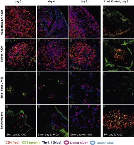 Figure 3. Triple-color immunofluorescence microscopy (IFM) of secondary lymphatic tissues and GVHD target organs. IFM was performed using 3 T-lymphocyte markers (antibody-conjugates): CD4-PE (red), CD8-FITC (green), and the donor-specific T-cell marker Thy1.1-APC (blue). Fresh frozen tissues sampled on 3 time points after transfer of allogeneic splenocytes (3, 4, and 6 days) are shown for mesenteric lymph nodes (mLNs) (panels A-C), spleen (panels E-G), and small bowel (panels I-K). Lymphatic tissues of day 3 (panels A,E) display a predominant infiltration by CD4+ donor T cells, which are confined to the corresponding T zones of mLNs and spleen, while target organs of day 3 remain negative for donor T cells. Day 4 represents a dramatic change in that the small bowel mucosa as a GVHD target tissue (panel J) is now infiltrated by donor T lymphocytes, predominantly CD4+, while lymphatic organs (panels B,F) shift to an expansion of CD8+ donor T cells (compare also Figure 4A). On day 6 all relevant GVHD target tissues are infiltrated by donor T cells, now predominantly CD8+, which are frequently in contact with CD4+ T cells of donor origin and sporadically with host CD4+ T cells (panels K,M-O). CD4+ and CD8+ T cells of host origin have mostly disappeared in mLNs, spleen, and small bowel of control tissues of Balb/c mice on day 6 after irradiation, which had not received an allogeneic transplantion (panels D,H,L). In contrast, PP samples of this control mouse show numerous CD4+ host T cells, which display a distinct membrane staining (panel P). The costaining for Thy1.1 was negative on all of the control tissues.