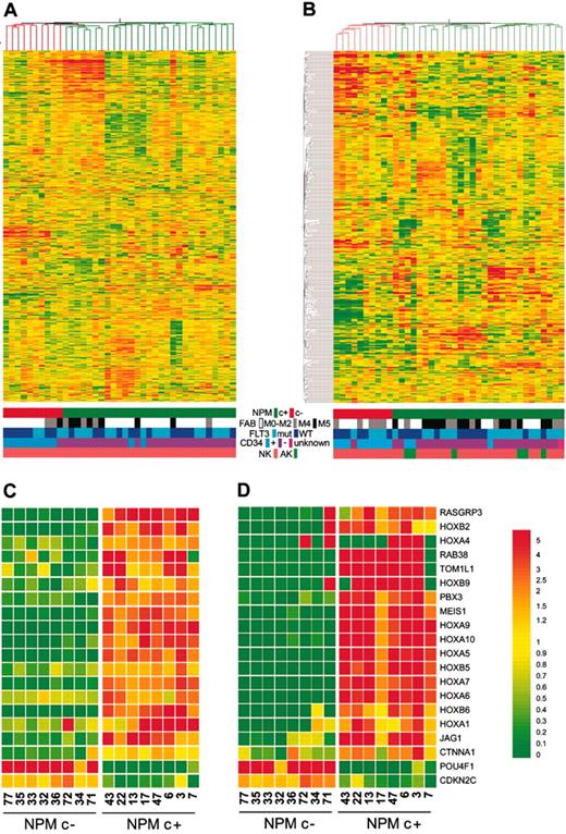 Figure 1. Gene-expression profiles of NPMc+ and NPMc– AML. (A) Unsupervised hierarchical clustering of the training set. The dendrogram at the top was obtained using a list of 7197 selected genes (see Document S1, available on the Blood website; see the Supplemental Materials link at the top of the online article). The strongest parameter in determining AML clustering is NPM localization. Each of the 39 columns represents an AML sample, and each of the 7197 rows represents a gene (probe set). Genes were clustered according to Pearson correlation (the structure of the gene tree is not shown). (B) Hierarchical clustering of the test set using 369 probe sets obtained from an analysis of variance of the training set (see Document S1). The predictor genes efficiently discriminate AML cases according to NPM localization. Each of the 39 columns represents an AML sample, and each of the 369 rows represents a gene (probe set). Genes were clustered according to Pearson correlation, and the structure of the gene tree is shown. Color scheme used to identify sample characteristics is shown between panels A and B. NK indicates normal karyotype; AK, abnormal karyotype. (C-D) Affymetrix (C) and reverse transcription–quantitative polymerase chain reaction (RT-qPCR) (D) analysis of expression levels of 20 genes (with the highest scores among the 369 predictors) evaluated in 16 patients (8 NPMc+ and 8 NPMc–, identified by numbers). (D) Relative expression levels are calculated as deviation from the median, and expression values for each gene in each sample are calculated as 2-ΔCT (ΔCT = difference between the mean threshold cycle for each specific gene and for the 18S control ribosomal RNA gene). In the vast majority of cases, RT-qPCR reflects the results expected from microarray analysis. Homeobox gene expression levels appear to be particularly elevated in NPMc+ AML. The color bar (D, right) represents the color scheme applied to all parts of the figure.
