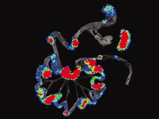 Bioluminescence imaging (BLI) of gastrointestinal tissues and spleen combined with histology and immunofluorescence microscopy of Peyer patches during induction of acute GVHD. See the complete figure in the article beginning on page 1113.