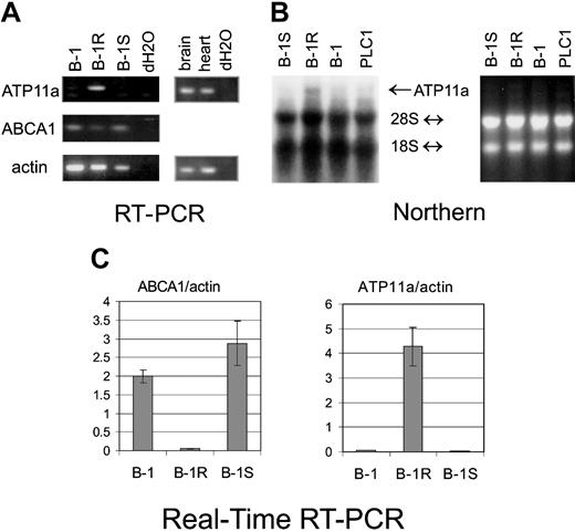 Figure 2. Expression of ATP11a mRNA in FTI-resistant lymphoblasts. (A) RT-PCR using primers for murine ATP11a (top) and ABCA1 (middle) or actin (bottom) on the mouse RNAs indicated above the panel. B-1 represents the original cells in short-term culture. (B) Northern blot analysis of ATP11a mRNA expression in pro-B-leukemia cells. The blot was hybridized to a mouse ATP11a probe and washed to a stringency of 0.01 × SSC, 65°C. The positions of 28 and 18S rRNA are as indicated. (Right) Ethidium bromide-stained gel; (left) autoradiogram. (C) Real-time RT-PCR using primers for ABCA1 (left) or ATP11a (right). Values are relative to those of actin. B-1R cells expressed 140-fold more mRNA for ATP11a and 50-fold lower levels of ABCA1 than B-1S cells. Primers used are described in “Materials and methods.” Error bars indicate standard deviation.