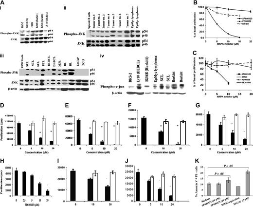 Figure 2. Constitutive expression of activated JNK and phospho-c-jun in B lymphomas and the effect of MAPK inhibitors on the growth of murine and human B-lymphoma cells. (A) Murine and human B-lymphoma cell lines (i), primary B lymphoma isolated from mouse (ii), and primary B-lymphoma samples from human patients (iii) expressed phosphorylated form of JNK constitutively with little expression by normal splenic B cells, normal peripheral blood human B cells, and prostate cancer cells (LNCaP and PC-3). A variety of B-lymphoma cell lines and tumors from both murine and human origin express phosphorylated form of c-jun constitutively (iv). Mouse primary tumors are spontaneous B lymphomas from aged mice (tumor nos. 1 to 7) and B lymphomas isolated from Eμ-Myc transgenic mice. Human primary B lymphomas include small-cell lymphoma (SCL), large-cell lymphoma (LCL), follicular cell lymphoma (FCL), Burkitt lymphoma (BL), and marginal zone lymphoma (MZL), which are characterized by flow cytometry. (B) BKS-2 B-lymphoma cells were cultured for 48 hours with vehicle (DMSO) alone or with indicated concentrations of SP600125 or PD98059. Results were expressed as percentage of basal proliferation (mean ± SE of triplicate cultures) when compared with cells that were not treated with any inhibitor. The actual counts are 61 449 ± 2636 for the untreated cells. (C) BJAB B-lymphoma cells were cultured for 48 hours with vehicle (DMSO) alone, or the indicated concentrations of SP600125, PD98059, or SB203580. The actual counts are 119 333 ± 7118 for the medium. Panels D, E, F, G, and H represent the effect of SP600125 on basal proliferation of CH12.LX, WEHI-231, CH31, Ramos, and RAJI B-lymphoma cells, respectively; panels I and J, of OCI-Ly7 and OCI-Ly10 DLBCL cells, respectively. For D-G and I-J, ▪ indicates SP600125; □, DMSO equivalents. (K) Annexin V staining of prostate cancer cell line PC-3 in the presence or absence of varying concentrations of SP600125 for 24 hours. MG132 is used as a positive control, which is a proteasome inhibitor. Results are presented as means ± SE of triplicate cultures. *P < .05 when comparing response with SP600125 to solvent or medium-only treatment. Results are representative of 3 experiments.