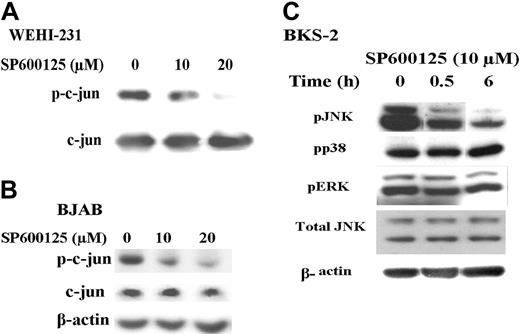 Figure 4. SP600125 inhibits c-jun phosphorylation but not phosphorylation of ERK or p38 MAPK. (A) WEHI-231 B-lymphoma cells were incubated with medium or treated with 10 μM SP600125 for 6 hours. In vitro kinase assays were performed on the cell lysates and subsequently analyzed by immunoblotting with an antibody to phospho-c-jun. (B) BJAB B-lymphoma cells were incubated with medium or treated with 10 μM SP600125 for 6 hours. Cell lysates were analyzed by immunoblotting with an antibody to phospho-c-jun. (C) BKS-2 B-lymphoma cells were incubated with medium or treated with 10 μM SP600125 for 6 hours. Cell lysates were analyzed by immunoblotting with an antibody to phospho-JNK, phospho-ERK, or phospho-p38. All the blots that were probed for phosphokinases were then stripped and reprobed with antibodies to total kinase or actin to correct for changes in protein loading in different lanes. Experiments were performed 2 times with similar results.
