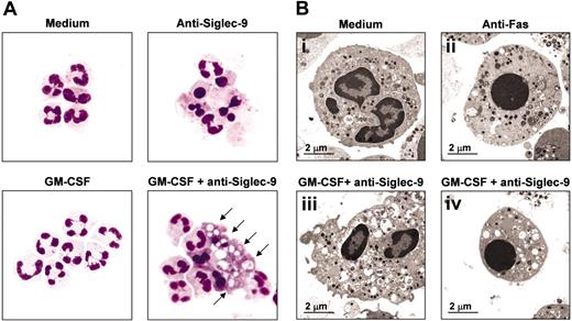 Figure 5. Morphologic characterization of the Siglec-9-mediated caspase-independent neutrophil death. (A) Light microscopy: anti-Siglec-9 cross-linking alone induced neutrophil apoptosis (reduced cell volume and nuclear condensation). GM-CSF followed by Siglec-9 engagement resulted in both apoptotic and aberrant neutrophil death. The aberrant death was characterized by cytoplasmic vacuolization (arrows). Cells were stained with Giemsa-May-GruĢnwald (Diff-Quik). Original magnification, Ć 1000. Representative examples of 4 independent experiments are shown. (B) Transmission electron microscopy: panel i demonstrates a normal viable neutrophil; panel ii shows an apoptotic neutrophil with condensation of the nucleus and cell shrinkage. Panels iii and iv demonstrate the aberrant morphology of GM-CSF-primed and Siglec-9-stimulated neutrophils, which contained many vacuole-like double-membrane structures. Approximately 25% of these cells showed condensation of the nucleus and cell shrinkage. The mitochondria were partially swollen. The plasma membrane appeared to be intact. The cells in panels A and B were from 15-hour cultures.