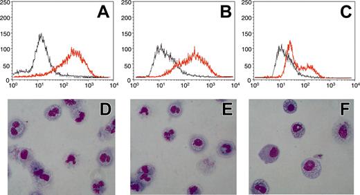 Figure 1. Conditional expression of CBFB-SMMHC in U937 leukemic cells blocks myeloid differentiation. U937 were treated with 0.5 μM ATRA for 5 days. CD11b expression was determined by FACS analysis (A-C) and morphology was examined by hematoxylin-eosin staining of cytospins at day 5 (D-F). Analysis was performed in U937T cells (A,D), in U937-tetoff-CBFB-SMMHC cells without induction of the CBFB-SMMHC fusion (B,E), and in U937-tetoff-CBFB-SMMHC cells following induction of CBFB-SMMHC protein (C,F). Gray lines indicate day 0; redlines, day 5 (A-C). Magnification (D-F) was × 40 with a Plan Fluor objective (Ph2 DLL; Nikon, Tokyo, Japan). Camera was a Nikon Digital Camera Dxm 12000. Acquisition software was from Lucia image (version 4; Prague, Czech Republic).
