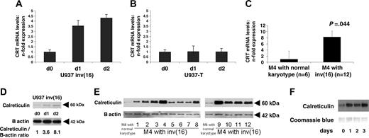 Figure 4. Calreticulin expression and activity are induced following conditional expression of CBFB-SMMHC in leukemic U937 cells and in CBFB-SMMHC AML-M4Eo patient samples. (A) Calreticulin (CRT) mRNA levels following induction of CBFB-SMMHC in U937 cells are determined by quantitative RT-PCR. Mean values and SDs (error bars) are shown. (B) Calreticulin mRNA levels are assessed by RT-PCR after withdrawal of tetracycline in the parental U937 T cells. (C) Calreticulin mRNA levels were determined in AML-M4 patients with CBFB-SMMHC compared to AML-M4 patients with a normal karyotype. (D) Calreticulin protein was analyzed by Western blot analysis in U937 cells following induction of CBFB-SMMHC by withdrawal of tetracycline. Quantification as calreticulin/β-actin ratio is indicated below. (E) Calreticulin protein was analyzed in AML-M4 patient samples with CBFB-SMMHC (lanes 1-8 and 9-12) and in representative AML-M4 patients with a normal karyotype (lanes 1 and 10). (F) Calreticulin activity of U937-CBFB-SMMHC cells following withdrawal of tetracycline was assessed by UV cross-linking to directly visualize the physical interaction between calreticulin protein and CEBPA mRNA.
