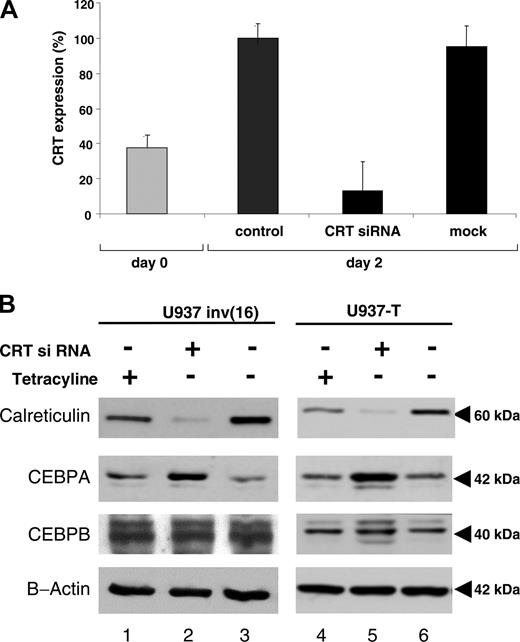 Figure 5. Inhibition of calreticulin expression by siRNA restores CEBPA protein expression. CBFB-SMMHC protein was induced in U937 cells by withdrawal of tetracycline. In addition, cells were either electroporated with siRNA designed to knock-down calreticulin or with mock siRNA as control, simultaneously with the onset of CBFB-SMMHC induction. (A) Quantitative RT-PCR of calreticulin mRNA at day 0 (▦) and 48 hours after induction of CBFB-SMMHC transfection with or without transduction with siRNA (▪). “Control” represents U937 cells after 48 hours of withdrawal of tetracycline and thus induction of CBFB-SMMHC, whereas “mock” represents U937 cells 48 hours after withdrawal of tetracycline and transduction with the Silencer Negative Control no. 2 siRNA (Ambion) to exclude unspecific effects of the transduction procedure. Mean values and SDs are shown. (B) Western blot analysis of calreticulin, CEBPA, CEBPB, and β-actin protein after withdrawal (-) of tetracycline or transduction (or both) with (+) calreticulin siRNA in the conditional U937 inv(16) cell line (left panels) and the parental U937-T cell line (right panels).