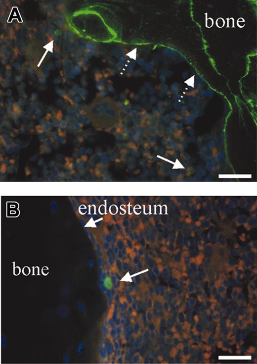 Figure 1. Immunohistochemical localization of Opn and correlation with CFSE+ donor cells in a longitudinal section of a murine femur. (A) Opn expression was highly restricted to the endosteum of the marrow cavity (dotted arrows) and correlated with the localization of 2 CFSE+ donor LSK cells (solid arrows). (B) Isotype control for Opn expression with 1 CFSE+ donor LSK cell (arrows). Counterstained with DAPI (4′, 6-diamino-2-phenylindole). Bars = 30 μm.