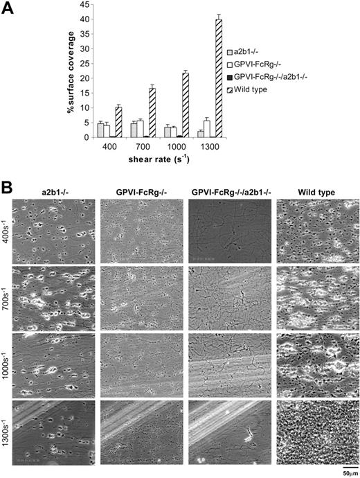 Figure 3. Platelets derived from mice genetically deficient in α2β1 integrin and/or GPVI-FcRγ demonstrate critical roles for both receptors during platelet deposition on fibrillar collagen under flow. Whole blood from the specified mice was perfused over an immobilized collagen surface for 4 minutes. (A) Surface coverage area of platelets from α2β1–/– (▦), GPVI-FcRγ–/– (□), GPVI-FcRγ–/–; α2β1–/– (▪), and wild-type (▨) after flow. The results shown are the mean ± SEM (n = 6-11). Statistical significance (P < .01) was seen between the knockouts and the control at and between 400 and 1300 s–1. (B) Representative phase-contrast images after perfusion. The lines seen in the upper left portions of some panels are visual artifact and do not arise due to abnormalities in the collagen-coated surface.
