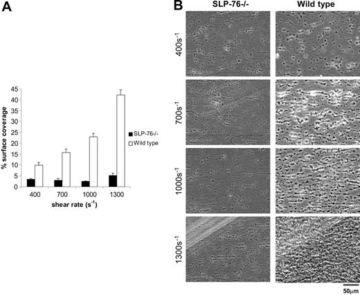Figure 4. Platelet deposition on collagen under flow requires signal transduction through the adaptor SLP-76. Whole blood from the indicated mice was perfused over collagen-coated glass slides at wall shear rates at and between 400 and 1300 s–1 for 4 minutes. (A) Percent surface coverage of SLP-76–deficient (▪;n = 5) and the wild-type (□;n = 3) platelets after whole blood perfusion over a collagen-coated surface. The results shown are the mean ± SEM. Statistical significance was seen between the SLP-76–deficient platelets and the control (P < .01) at the specified shear rates. (B) Representative phase-contrast images after perfusion. The lines seen in the upper left portions of some panels are visual artifact and do not arise due to abnormalities in the collagen-coated surface.