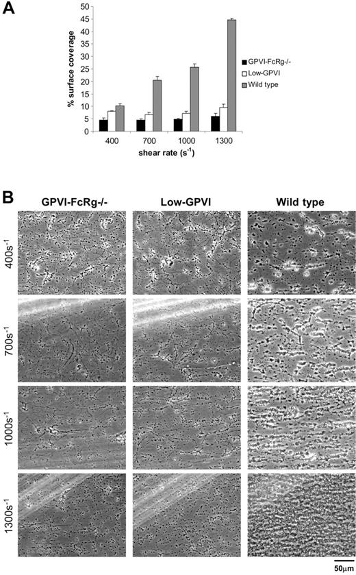 Figure 6. Low levels of GPVI reduce deposition of platelets on collagen under shear stress. Whole blood from the indicated mice was perfused over collagen-coated glass slides at wall shear rates at and between 400 and 1300 s–1 for 4 minutes. (A) Percent surface coverage of GPVI-FcRγ–/– (▪), low-GPVI (□), and wild-type (▦) platelets. The results shown are the mean ± SEM after analysis of the phase-contrast images (n = 5). Statistical significance was seen between GPVI-FcRγ–/–, low-GPVI, and wild-type at and between 400 s–1 and 1300 s–1 (P < .01). (B) Representative phase-contrast images after flow. The lines seen in the upper left portions of some panels are visual artifact and do not arise due to abnormalities in the collagen-coated surface.