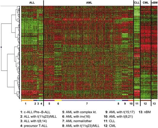 Figure 1. Hierarchical cluster analysis of 937 samples. Analysis of 937 samples (columns) using a set of 1019 differentially expressed genes (rows). The normalized expression value for each gene is coded by color (SD from mean). Red cells indicate high expression, and green cells indicate low expression. Bars separate the major leukemia types. For each of the 13 classes, the top 100 differentially expressed genes, according to t test statistic, were used. Of the 1300 genes, 281 were repeatedly identified as important diagnostic markers and overlapped among the lists of the top 100 genes, resulting in 1019 nonoverlapping genes.