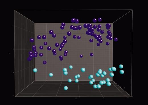 Figure 2. Distinction between precursor B-ALL and T-ALL. In 3-dimensional PCA, 114 ALL samples were projected into the feature space consisting of a combination of the top 100 differentially expressed genes when comparing precursor B-ALL with the other 12 classes or T-ALL with the other 12 classes. Data points with similar characteristics will cluster together. Here, a single color-coded sphere represents each patient's expression pattern. The respective label (ie, precursor B-ALL or T-ALL) was unknown to the algorithm. Labels and coloring of the classes were added after the analysis of means for better visualization. Pre–B-ALL samples (n = 82) are blue and include 42 c-ALL/pre–B-ALL with t(9;22) and 40 c-ALL/pre–B-ALL without t(9;22). T-ALL samples (n = 32) are turquoise.