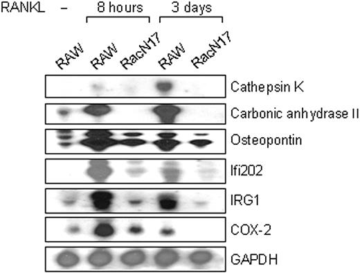 Figure 1. Identification of specifically expressed genes in RANKL-stimulated RAW 264.7 cells. Northern blot analysis of genes expressed during osteoclast differentiation. Total RNA was extracted from RAW264.7 and RAW-RacN17 cells stimulated with RANKL for the indicated periods. Total RNA (20 μg) was applied to each lane. cDNAs for cathepsin K, carbonic anhydrase II, osteopontin, Ifi202, IRG1, and COX-2 were used to prepare probes and hybridized to total RNA. GAPDH (glyceraldehyde-3-phosphate dehydrogenase) was used as a control for total RNA loading.